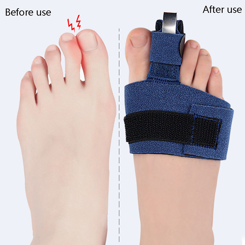 1Pcs Toe Corrector Toe Fractur - Ankle Brace Sock recension och pris